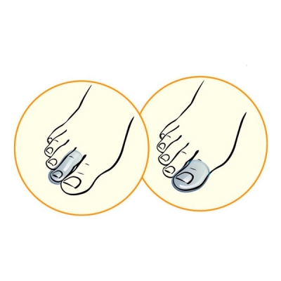 Протектор для пальцев стопы TALUS